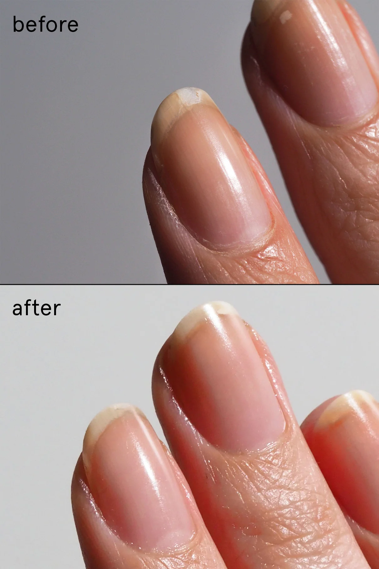 Nail Recovery Treatment - Image 3